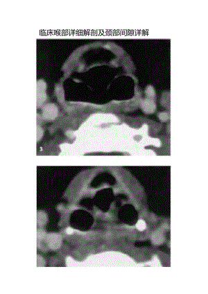 临床喉部详细解剖及颈部间隙详解.docx