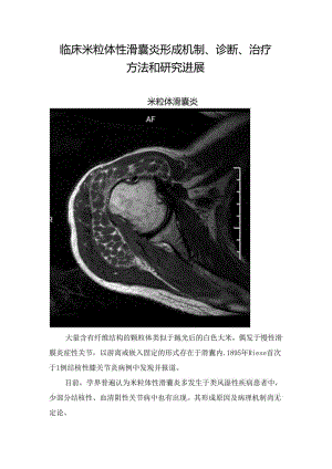 临床米粒体性滑囊炎形成机制、诊断、治疗方法和研究进展.docx
