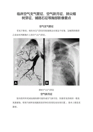 临床空气支气管征、 空气新月征、肺尖帽树芽征、铺路石征等胸部影像要点.docx