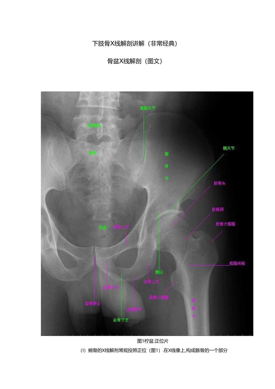 下肢骨X线解剖讲解非常经典.docx_第1页