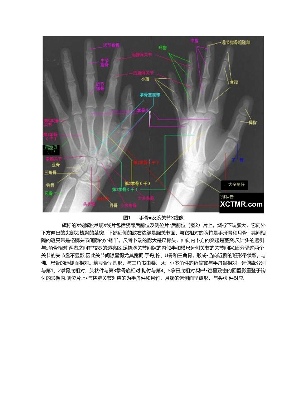 下肢骨X线解剖讲解非常经典.docx_第3页