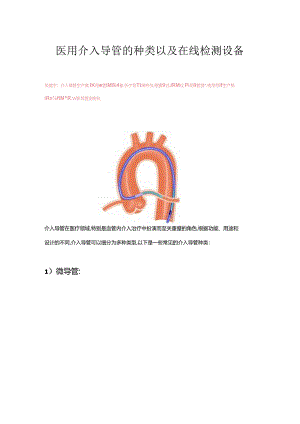 介入导管的种类以及在线检测设备.docx