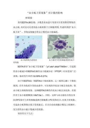 “血小板卫星”现象.docx