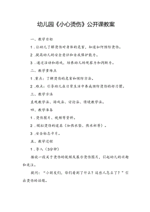 幼儿园《小心烫伤》公开课教案.docx