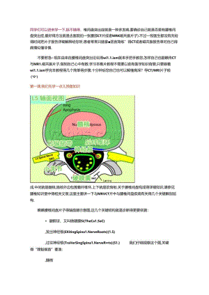 腰椎MR-一瞧就会.docx