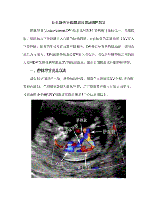 胎儿静脉导管血流频谱及临床意义.docx