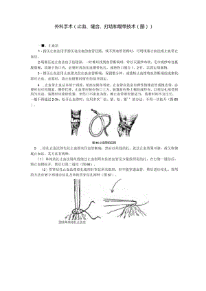 外科手术止血、缝合、打结及绷带技术图.docx