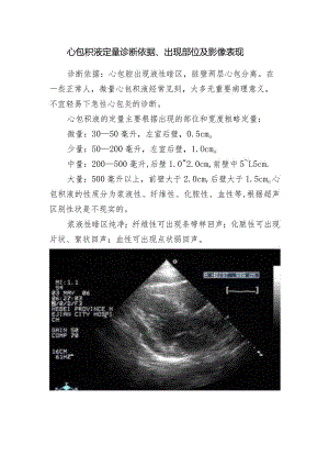 心包积液定量诊断依据、出现部位及影像表现.docx