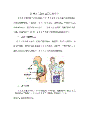 海姆立克急救法的标准动作.docx