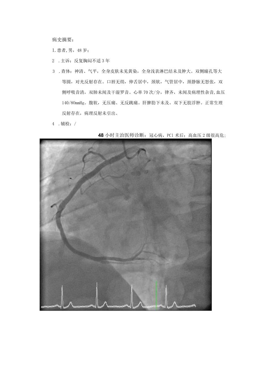 RCA开口左面.docx_第1页