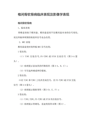 椎间骨软骨病临床表现及影像学表现.docx