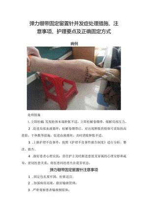 临床弹力绷带固定留置针并发症处理措施、注意事项、护理要点及正确固定方式.docx