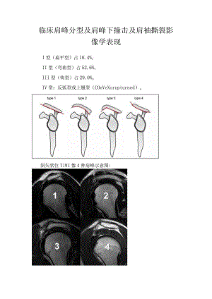 临床肩峰分型及肩峰下撞击及肩袖撕裂影像学表现.docx