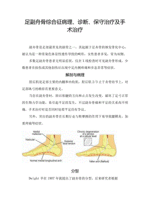 足副舟骨综合征病理、诊断、保守治疗及手术治疗.docx