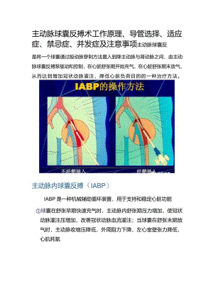 临床主动脉球囊反搏术工作原理、导管选择、适应症、禁忌症、并发症及注意事项.docx