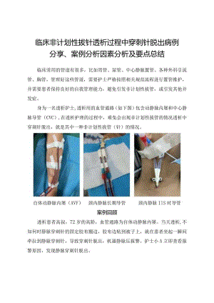 临床非计划性拔针透析过程中穿刺针脱出病例分享、案例分析因素分析及要点总结.docx