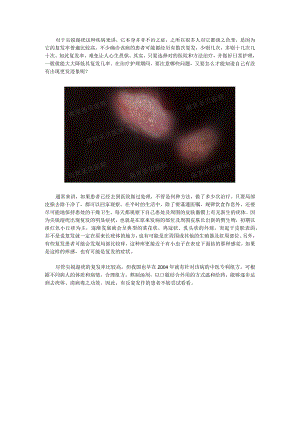 疣体复发前有症状吗.docx