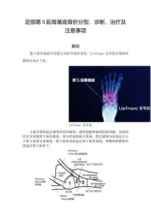 足部第5跖骨基底骨折分型、诊断、治疗及注意事项.docx