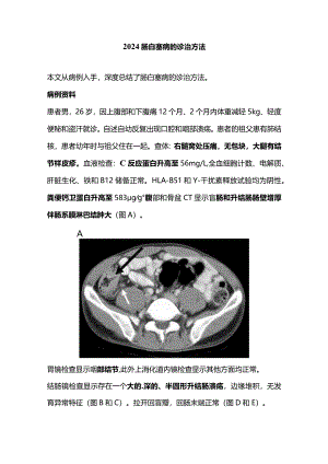 2024肠白塞病的诊治方法.docx