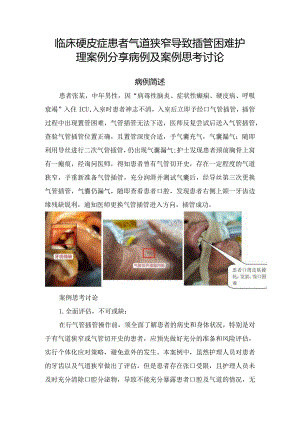 临床硬皮症患者气道狭窄导致插管困难护理案例分享病例及案例思考讨论.docx