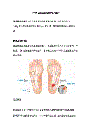 2024足底筋膜炎的诊断与治疗.docx