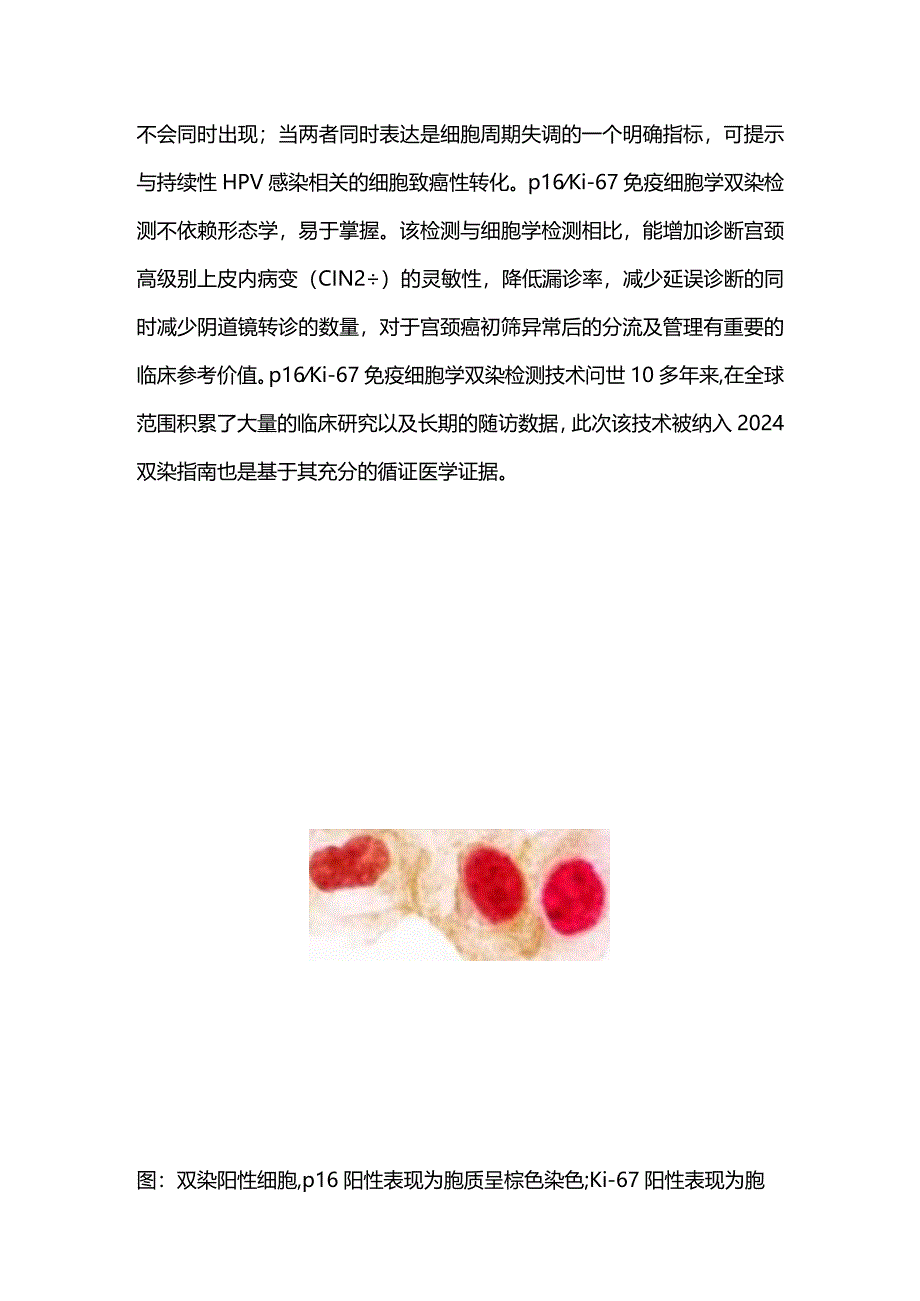 2024高危HPV阳性后续分流及管理要点.docx_第2页