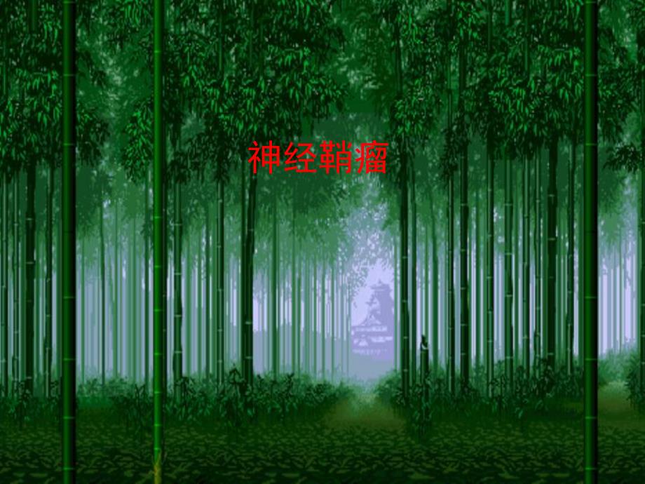 医学神经鞘瘤.ppt_第1页