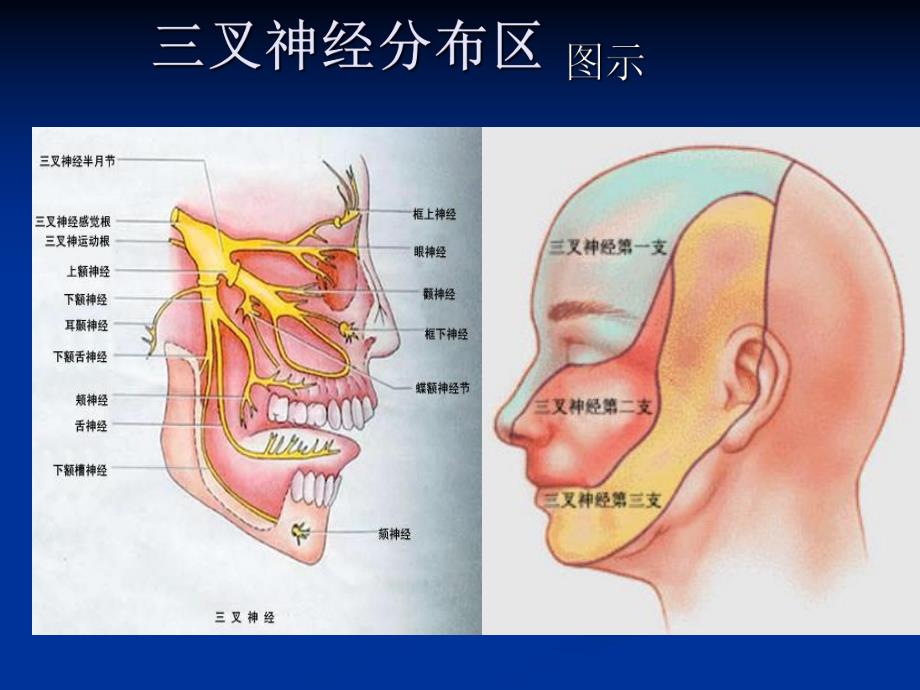 三叉神经痛(讲).ppt.ppt_第3页