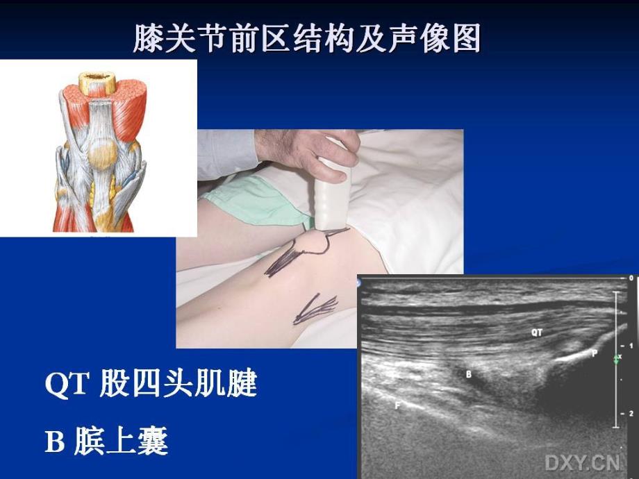 正常膝关节超声检查.ppt_第3页