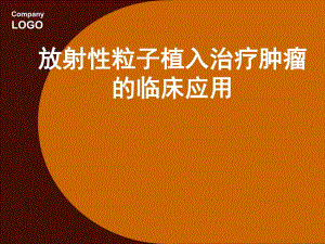放射性粒子植入治疗肿瘤.ppt