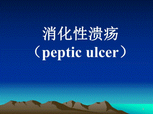 消化性溃疡防治指南（精品） .ppt