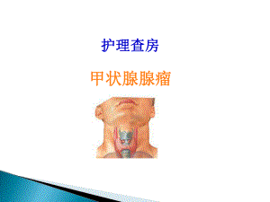 甲状腺腺瘤护理查房.ppt