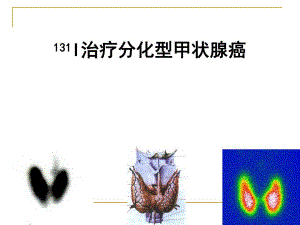 治疗分化型甲状腺癌.ppt