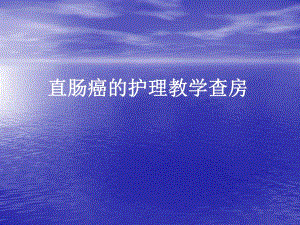 直肠癌护理教学查房.ppt