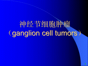 神经节细胞肿瘤.ppt