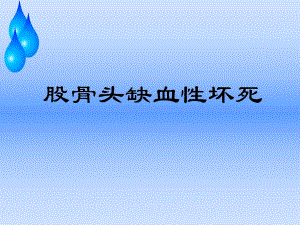 股骨头缺血性坏死护理查房.ppt