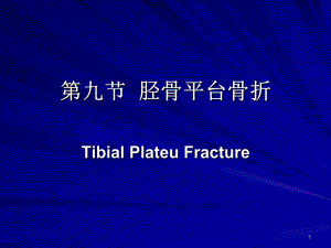 胫骨平台骨折PPT.ppt