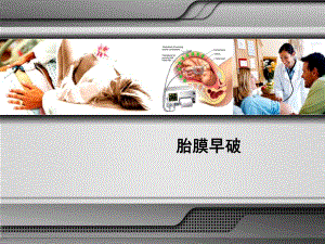 胎膜早破.ppt