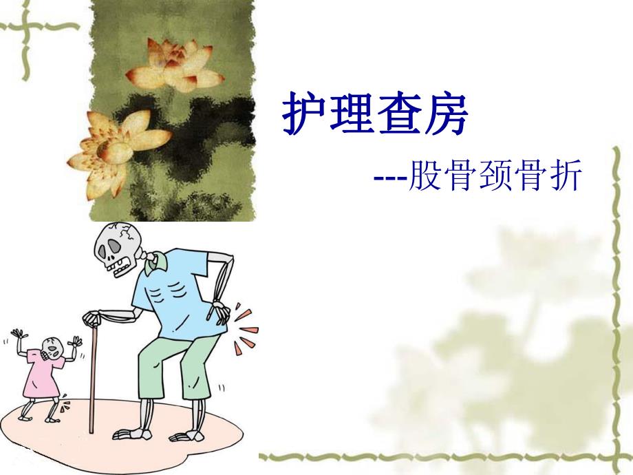 股骨颈骨折的护理查房.ppt_第1页