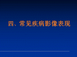肝胆胰脾常见病.ppt