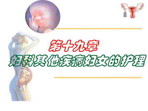 第十九章妇科其他疾病妇女的护理.ppt