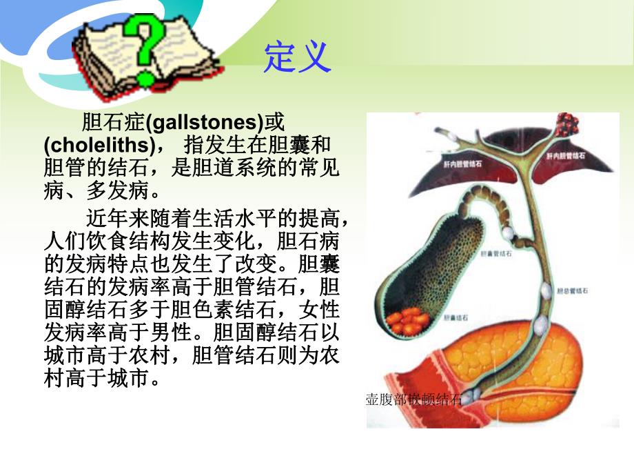 胆石症的护理查房.ppt_第2页