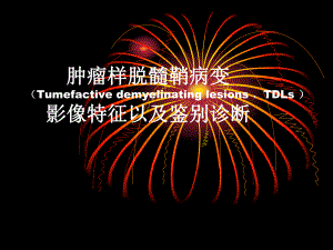 肿瘤样脱髓鞘病变影像特征以及鉴别诊断.ppt