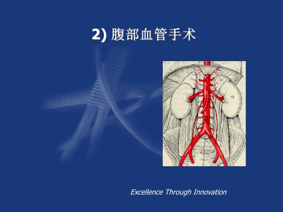 阜外大血管：腹部血管手术.ppt_第1页