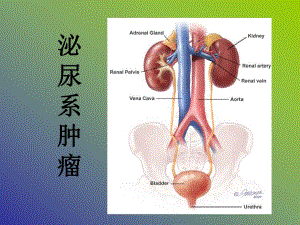 膀胱肿瘤.ppt