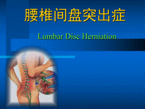腰椎间盘突出症医学演示文稿.ppt