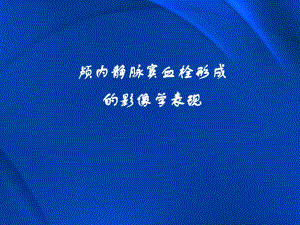 颅内静脉窦血栓形成的影像学表现.ppt