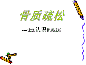 骨质疏松.ppt