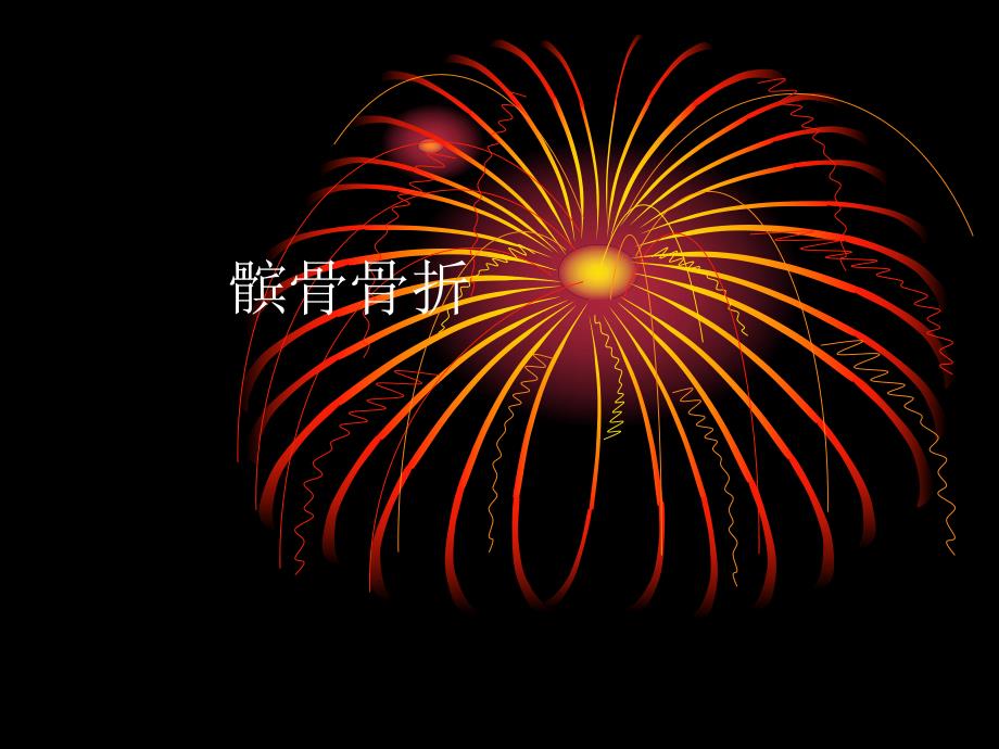 髌骨骨折护理查房.ppt_第1页