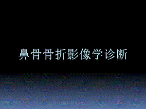 鼻骨骨折影像学诊断与鉴别.ppt